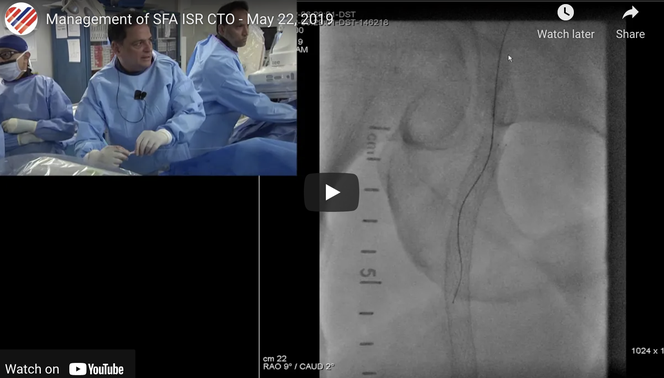 Management of SFA ISR CTO